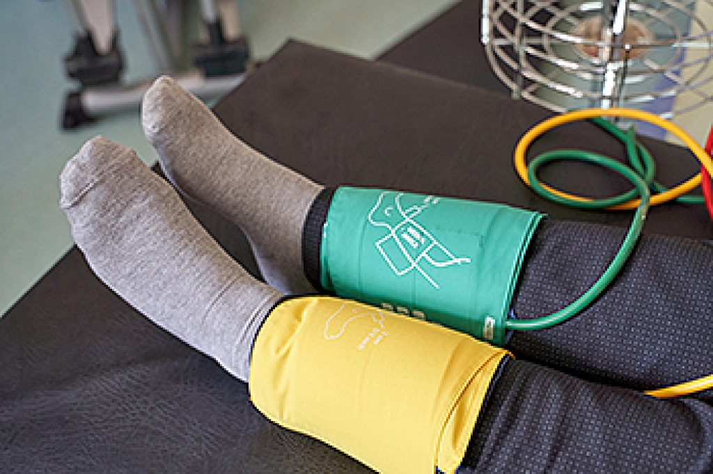 Intermittent Claudication and Peripheral Artery Disease