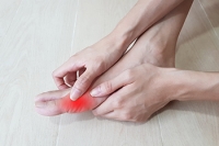 Managing Gout Pain